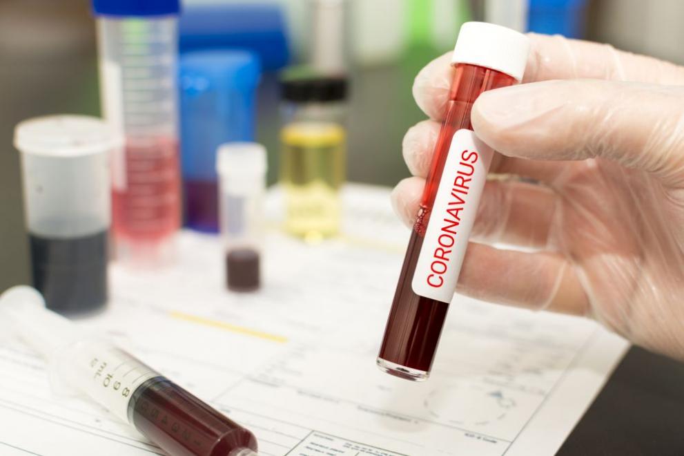 Над 50% спад на новите случаи на коронавирус в община Сливен спрямо предходната седмица