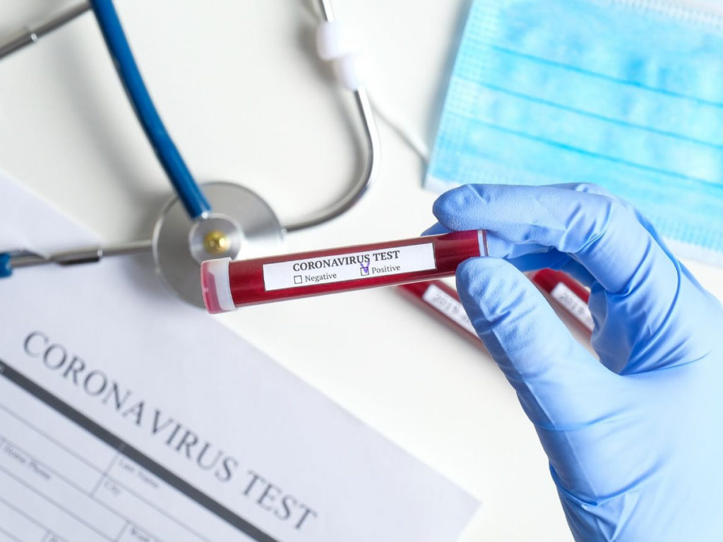 Няма нови случаи на заразени с коронавирус в област Сливен